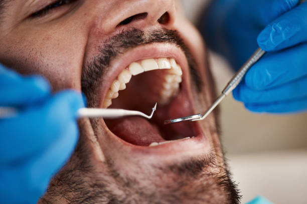 Best Emergency Dental Care for Abscessed Tooth in Meridian, PA