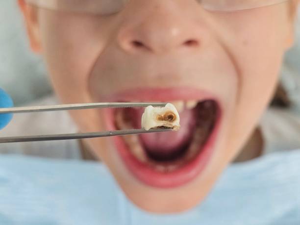 Best Pediatric Emergency Dentist in Meridian, PA